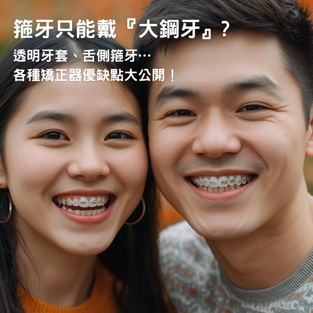 【箍牙只能戴『大鋼牙』？透明牙套、舌側箍牙…各種矯正器優缺點大公開！】